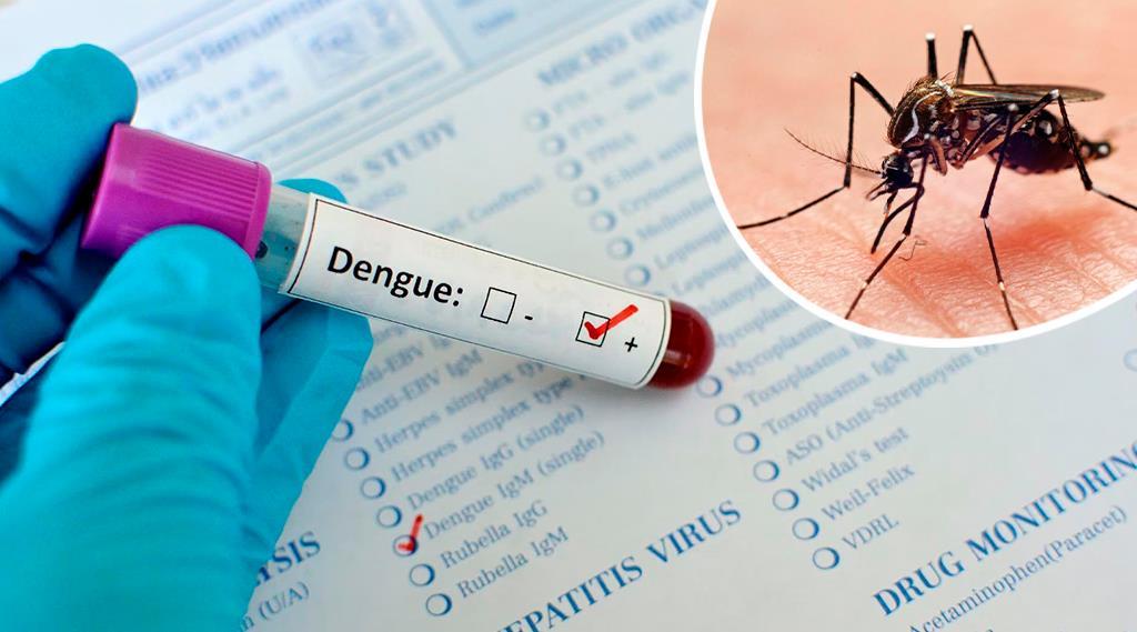 Notiprensa DigitalSVI: Pruebas de Dengue pueden costar entre 5 y 6